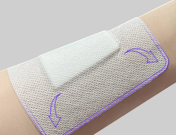 水胶体无菌敷贴/防粘连愈合快